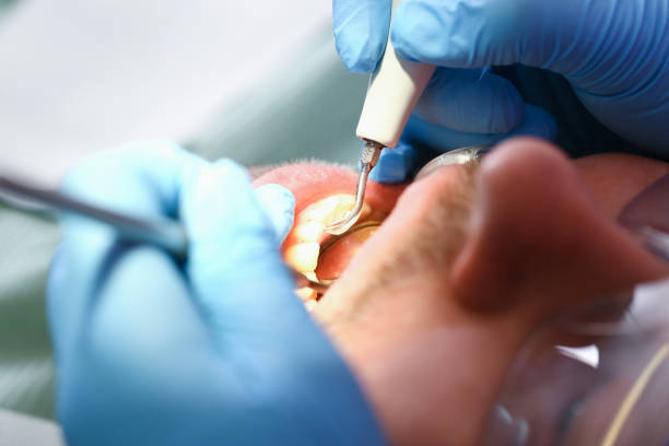 Best Emergency Denture Repair in Lewisburg, TN