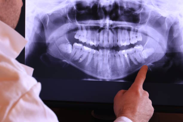 Best Emergency Dental Care for Broken or Chipped Teeth in Lewisburg, TN